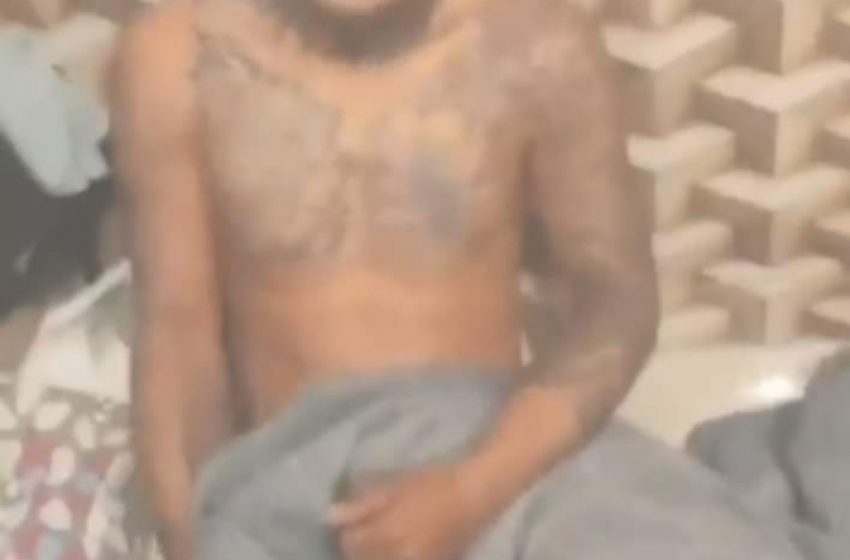  Cortando o mal pela raiz! Mulher descobre traição do marido e corta pênis dele.