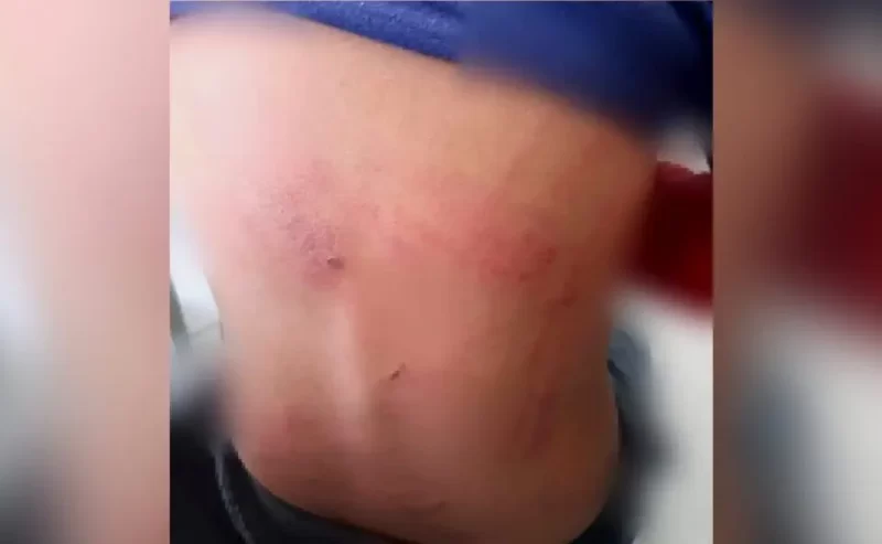  Casal é preso suspeito de agredir menino de 7 anos, em Araucária; Conselho Tutelar faz alerta